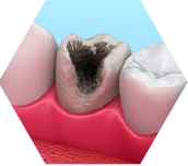 虫歯の有無、歯や骨の状態が気になる方