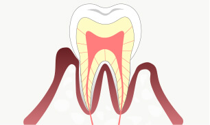 歯茎の検査